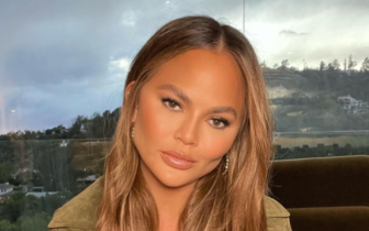 chrissy teigen buccal fat removal