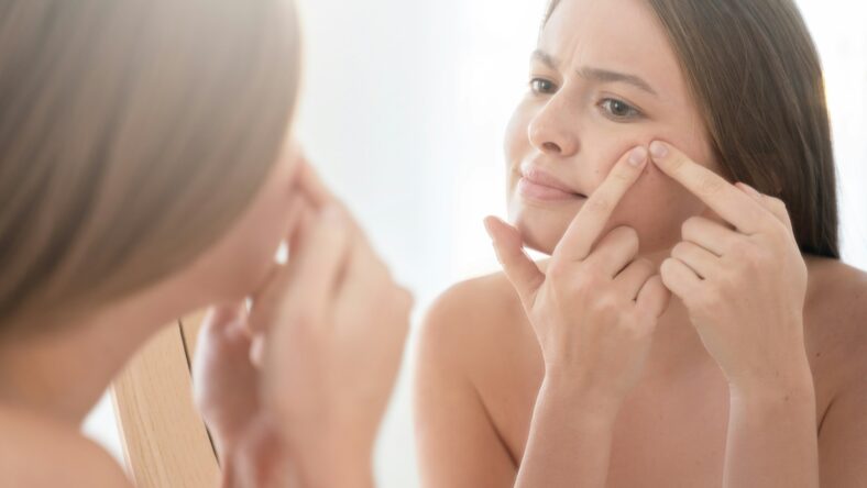 ways to remedy an over-picked pimple