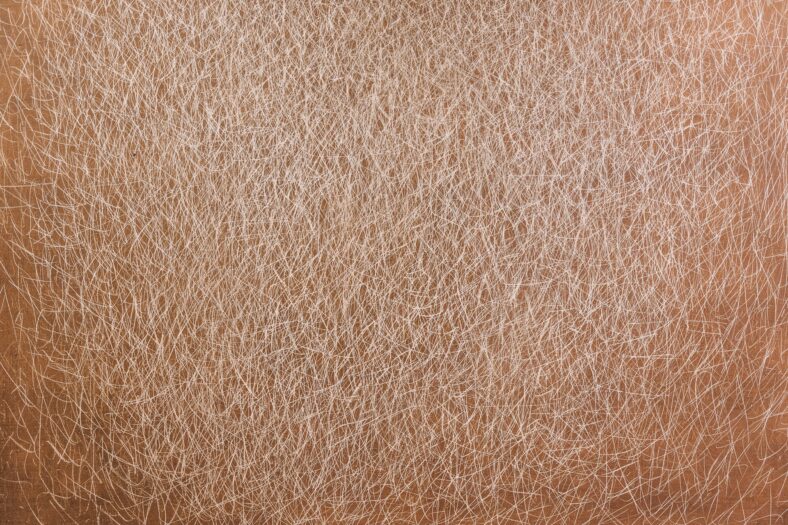 dry scaly skin